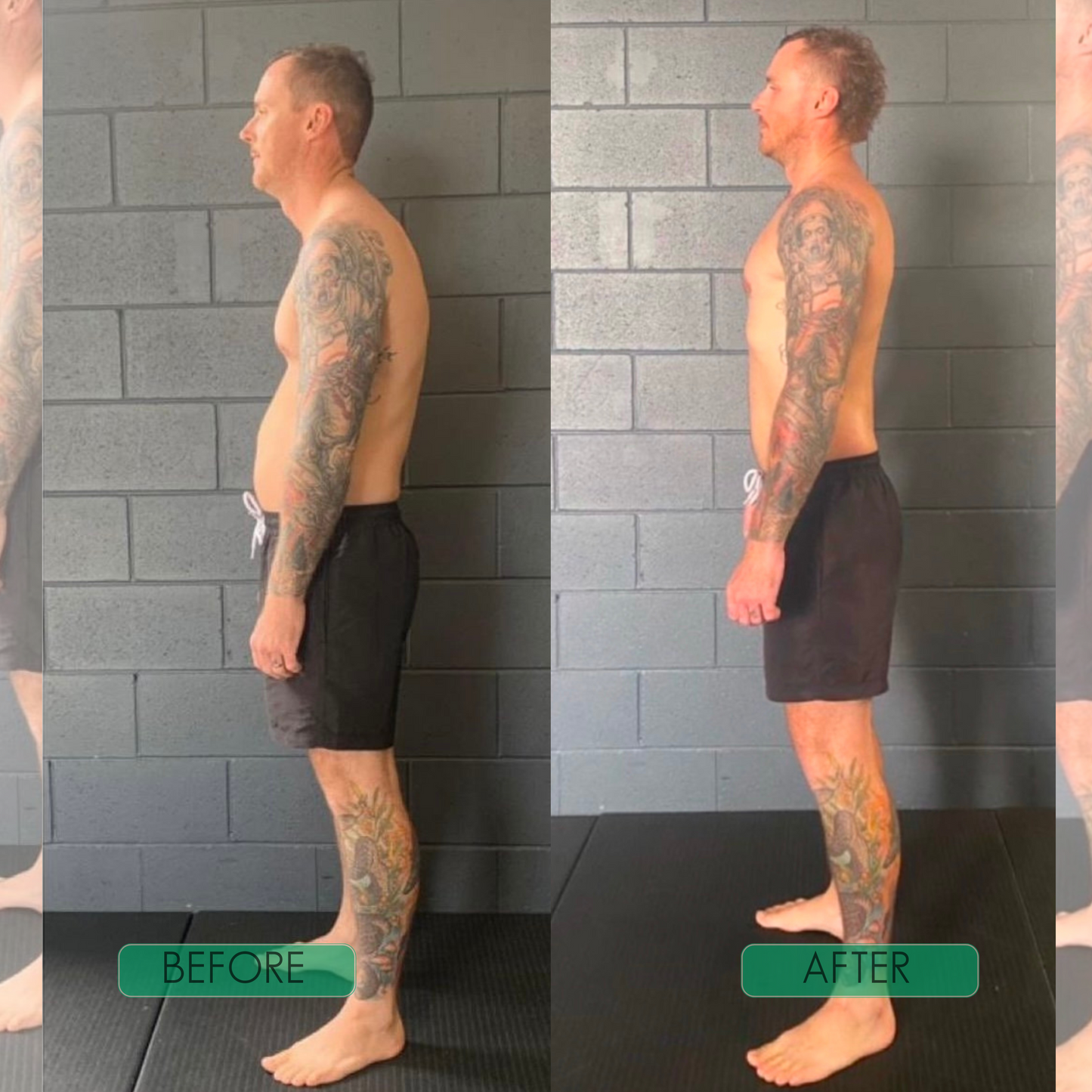 QuickAlign Posture Buddy