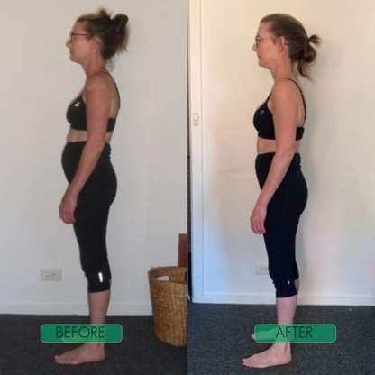 QuickAlign Posture Buddy